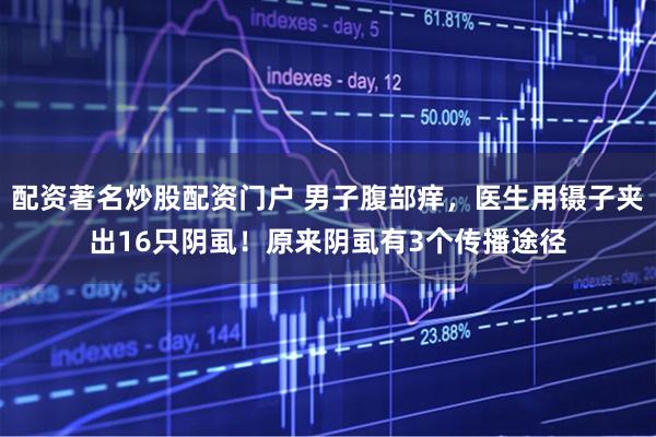 配资著名炒股配资门户 男子腹部痒，医生用镊子夹出16只阴虱！原来阴虱有3个传播途径
